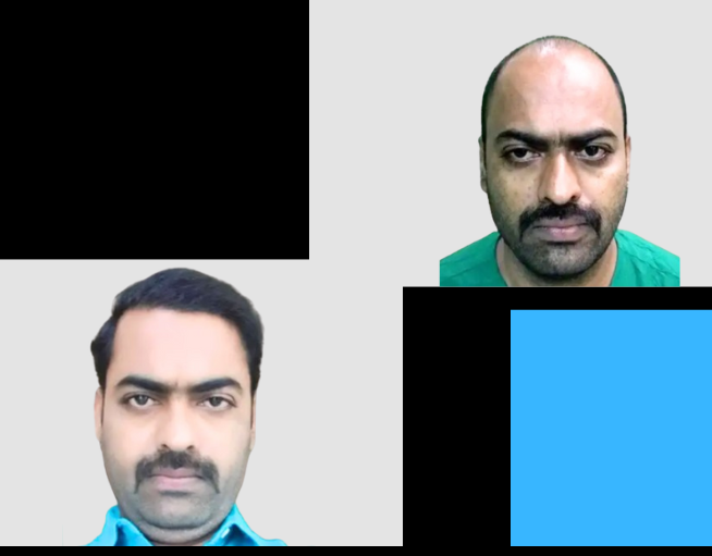Hair Transplant Mumbai