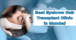Best Eyebrow Hair Transplant Clinic in Mumbai