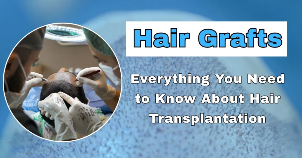 Hair Grafts: Everything You Need to Know About Hair Transplantation