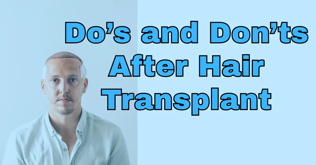 Do’s and Don’ts After Hair Transplant