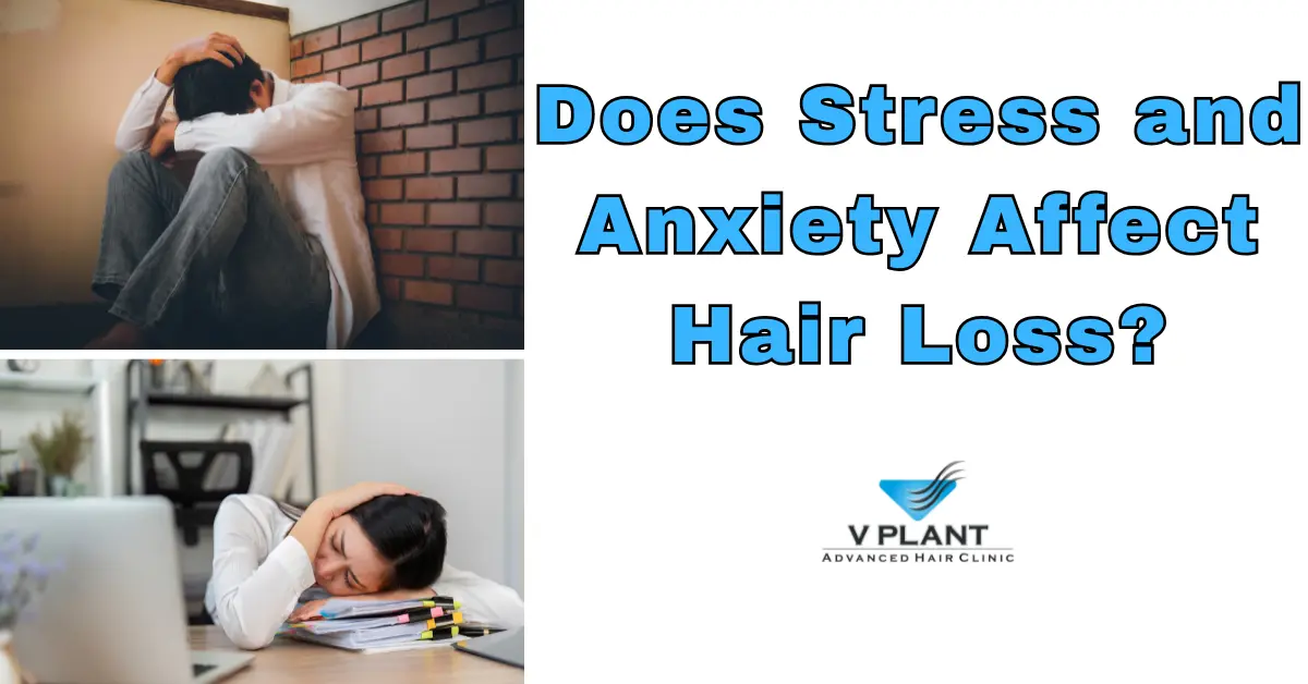 Does Stress and Anxiety Affect Hair Loss?