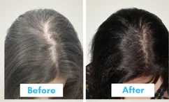 Duta Shots Before after