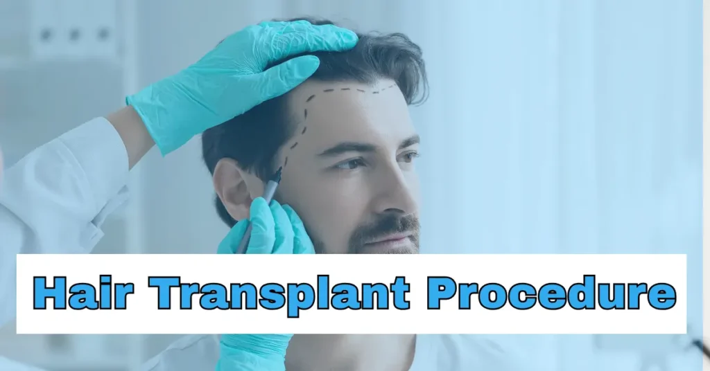 Hair Transplant Procedure: A Complete Guide to Hair Restoration