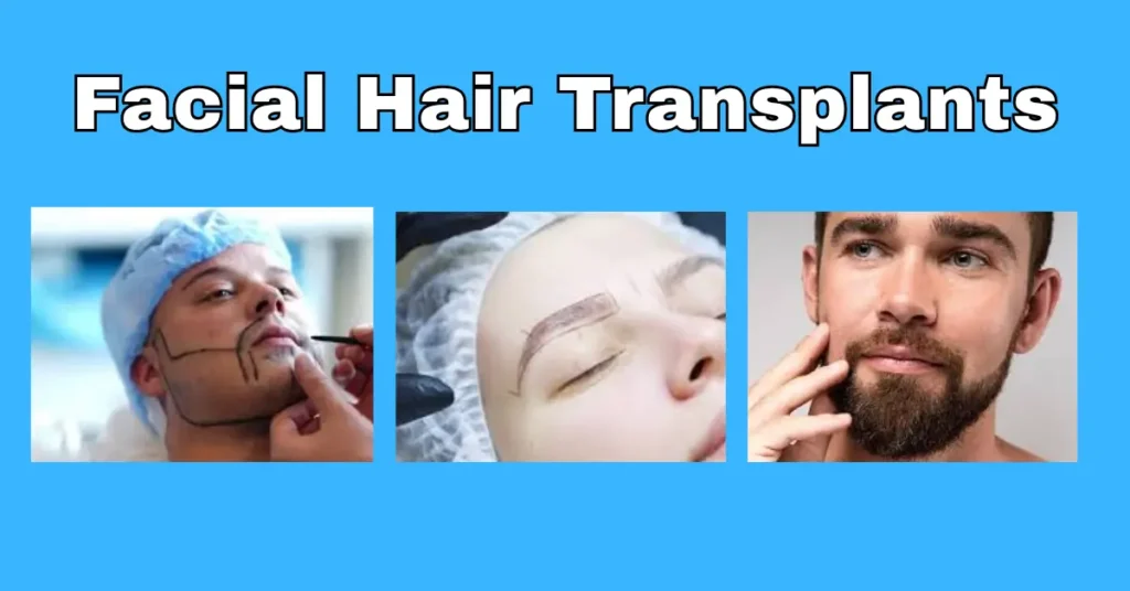 Facial Hair Transplants: Beard, Mustache & Eyebrow Trends