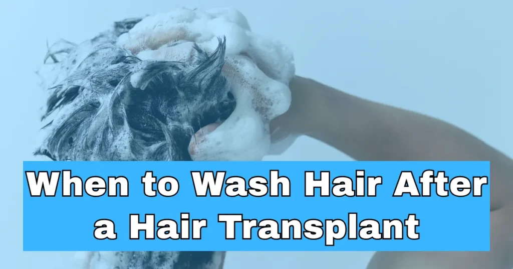 When to Wash Hair After a Hair Transplant