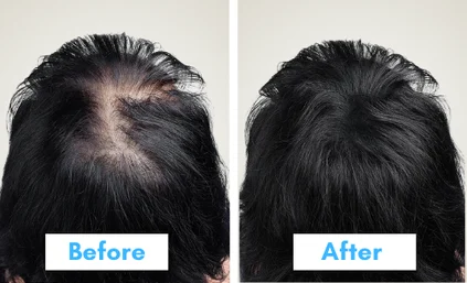 pdo threads before and after