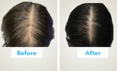 Qr678 Treatment in Mumbai