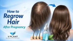 How to Regrow Hair After Pregnancy